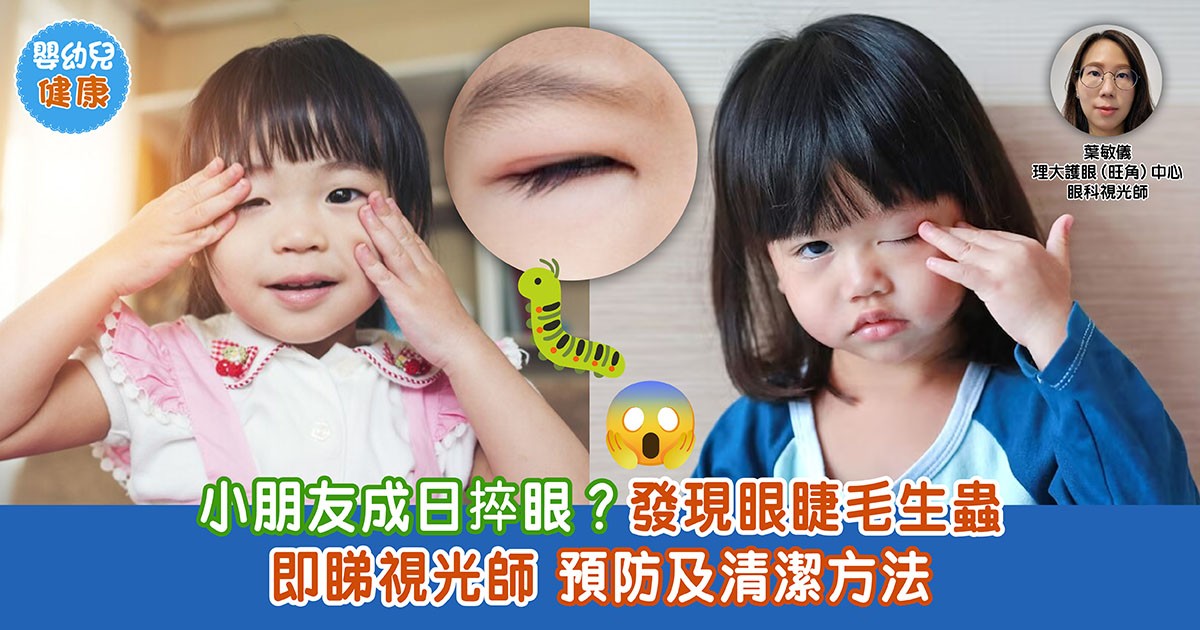 眼睛健康|小朋友捽眼發現眼睫毛生蟲?睇視光師 預防及清潔方法
