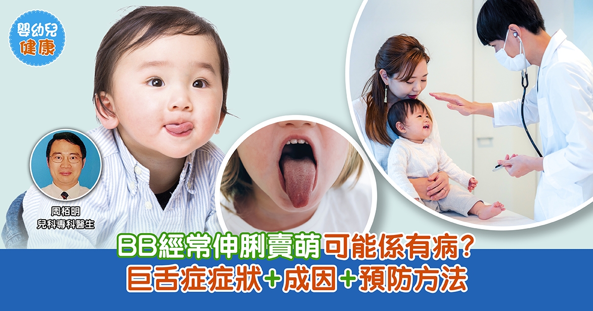 嬰幼兒健康｜BB經常伸脷賣萌可能係有病？巨舌症症狀+成因+預防方法