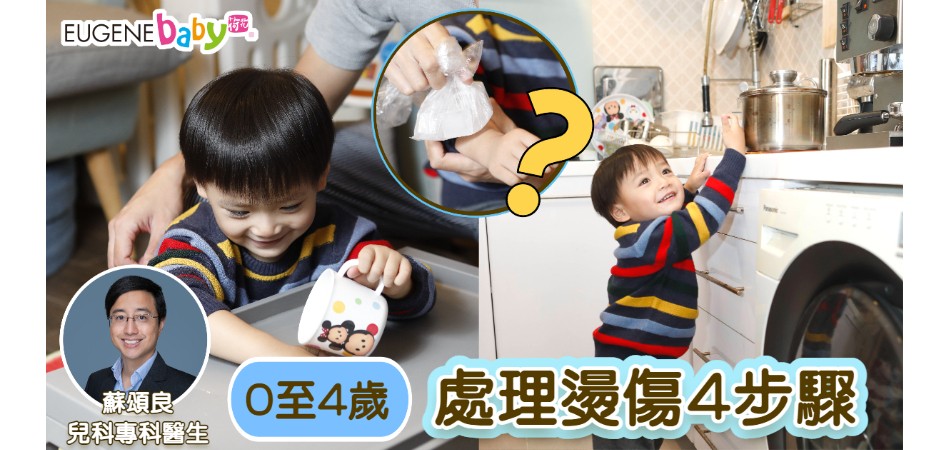 0至4歲最易被燙傷|兒科醫生教你燙傷處理4步驟