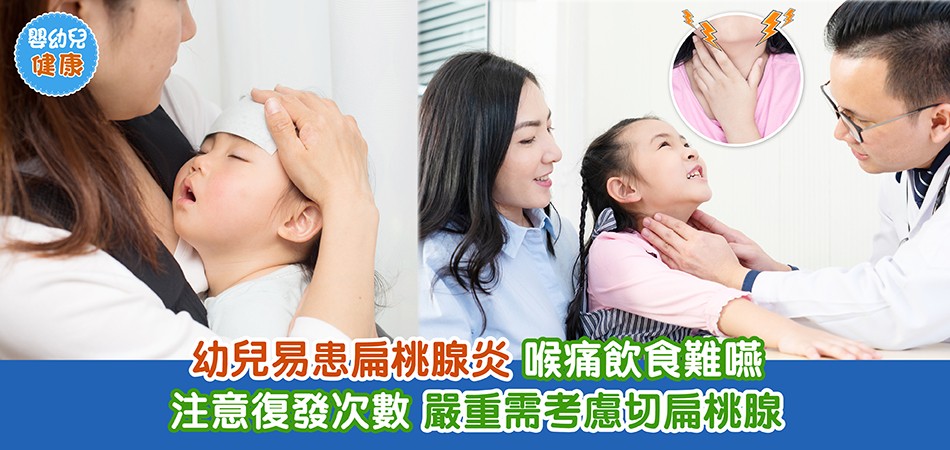 嬰幼兒健康｜幼兒易患扁桃腺炎 喉痛飲食難嚥 注意復發次數 嚴重需考慮切扁桃腺