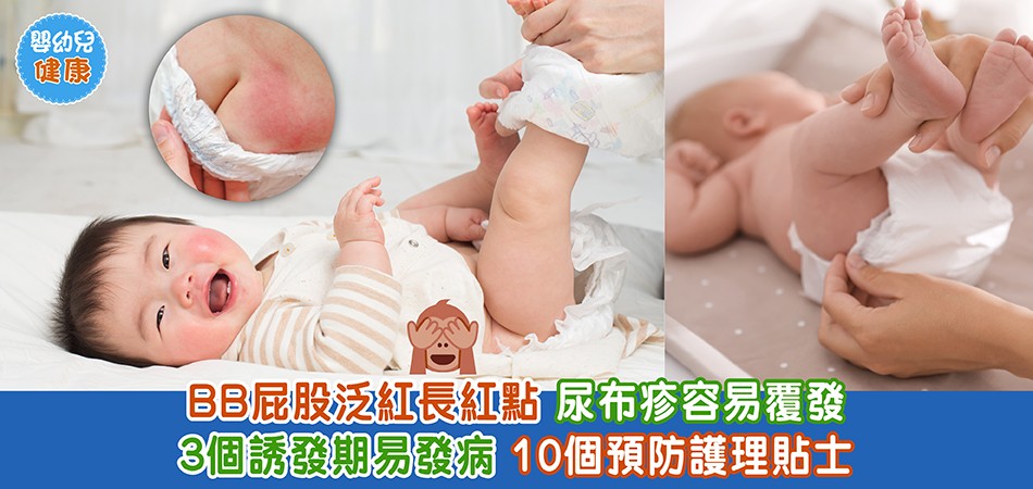 秋冬嬰幼兒健康｜BB屁股泛紅長紅點 3個尿布疹的誘發期+10個預防護理貼士