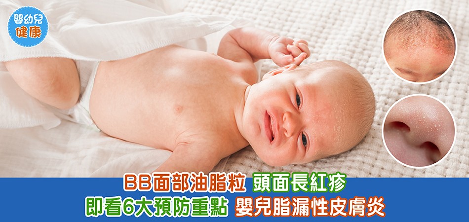 秋冬嬰幼兒健康｜嬰兒脂漏性皮膚炎 BB面部油脂粒+頭面長紅疹 6大預防重點