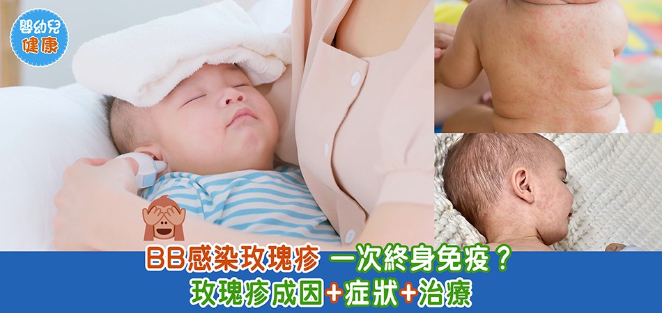 秋冬嬰幼兒健康｜BB感染玫瑰疹 一次終身免疫？ 玫瑰疹成因+症狀+治療