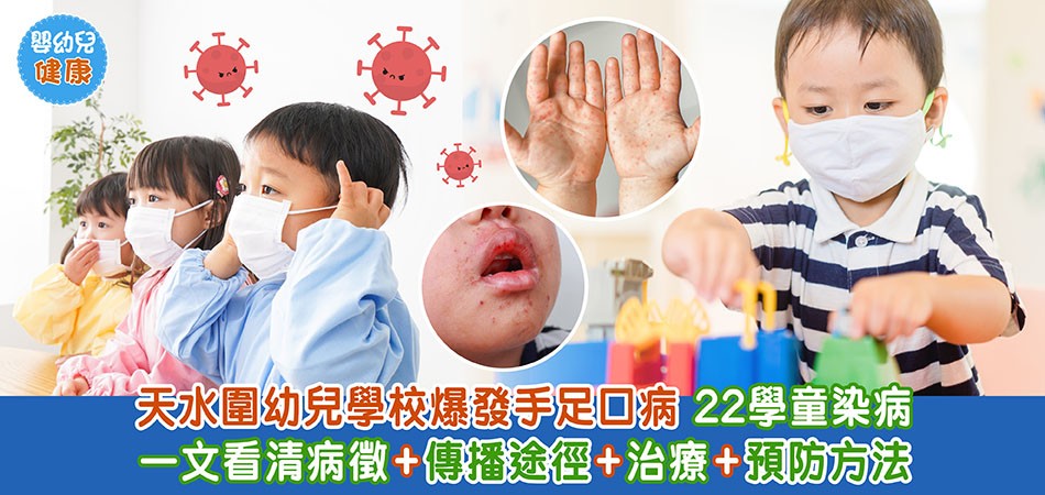 嬰幼兒健康｜天水圍幼兒學校爆發手足口病22學童染病 一文看清病徵+傳播途徑+治療+預防方法