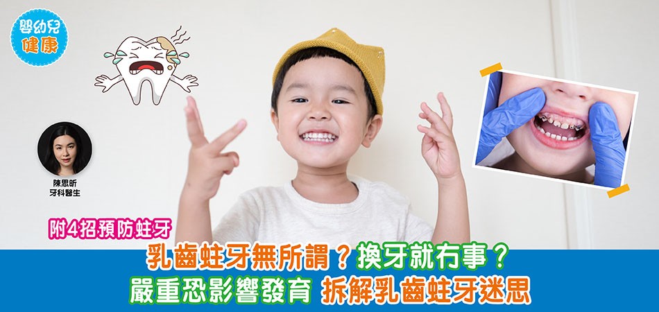 嬰幼兒健康｜乳齒蛀牙沒有所謂？換牙就沒事？ 嚴重恐影響發育 拆解乳齒蛀牙迷思 附4招預防蛀牙