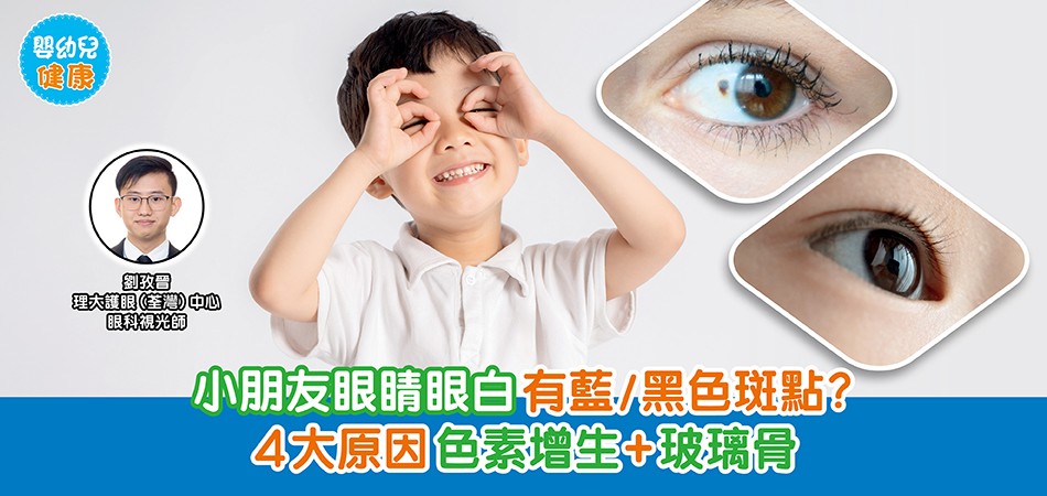 眼睛健康｜小朋友眼睛眼白有藍/黑色斑點？4大原因 色素增生+玻璃骨引致
