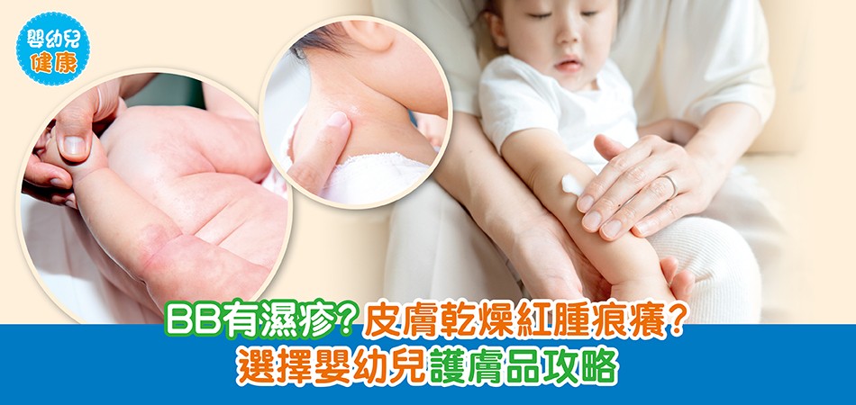 嬰幼兒健康|BB有濕疹?皮膚乾燥紅腫痕癢?選擇嬰幼兒護膚品攻略 嬰幼兒健康|BB有濕疹?皮膚乾燥紅腫痕癢?選擇嬰幼兒護膚品攻略