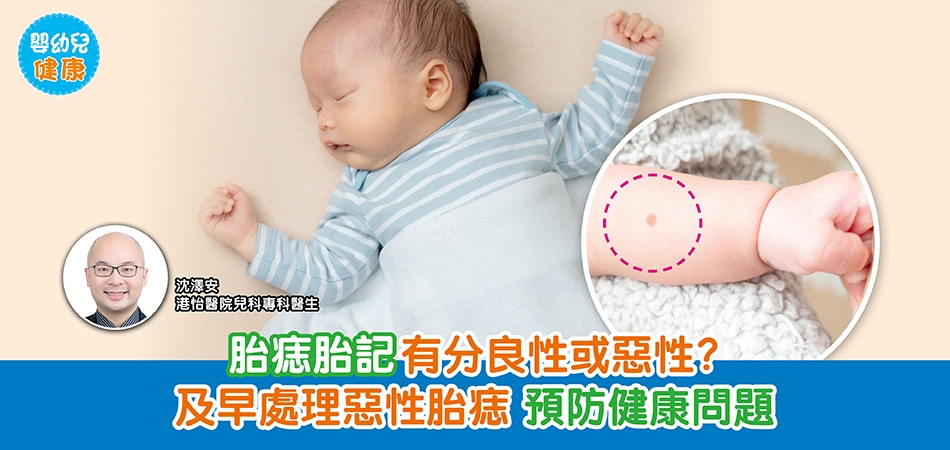 嬰幼兒健康｜胎痣胎記有分良性或惡性？及早處理惡性胎痣 預防健康問題