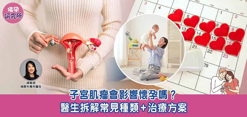 備孕研究所｜子宮肌瘤會影響懷孕嗎？醫生拆解常見種類+治療方案