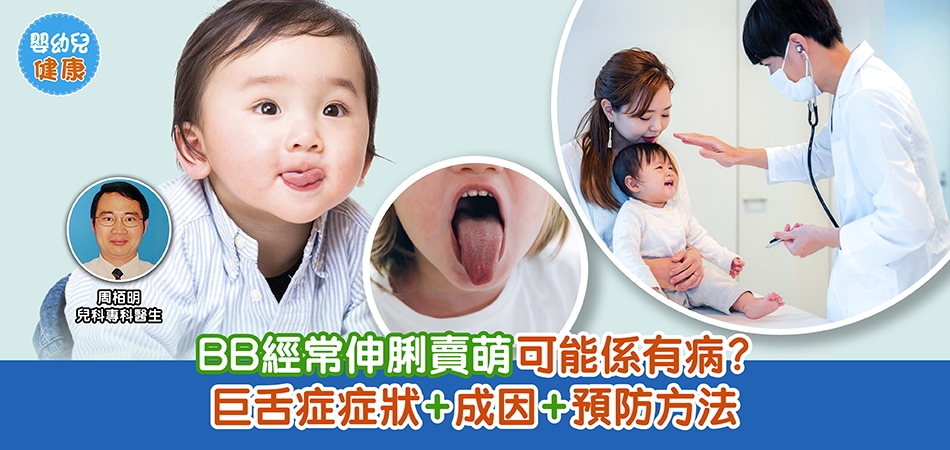 嬰幼兒健康｜BB經常伸脷賣萌可能係有病？巨舌症症狀+成因+預防方法