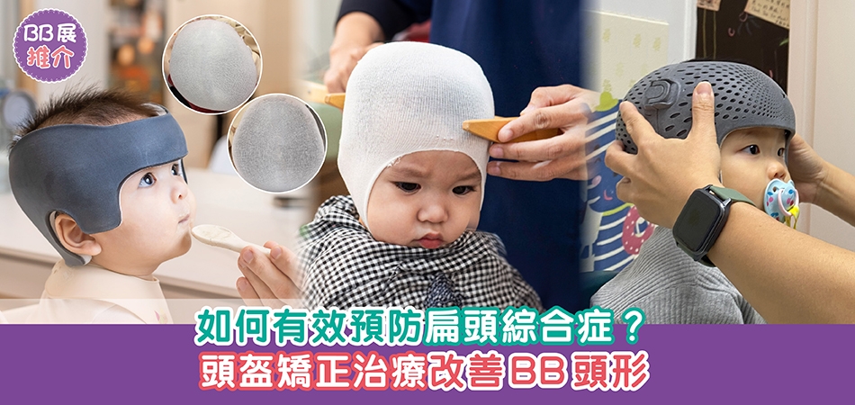 荷花BB展2026推介｜如何有效預防扁頭綜合症？頭盔矯正治療改善BB頭形