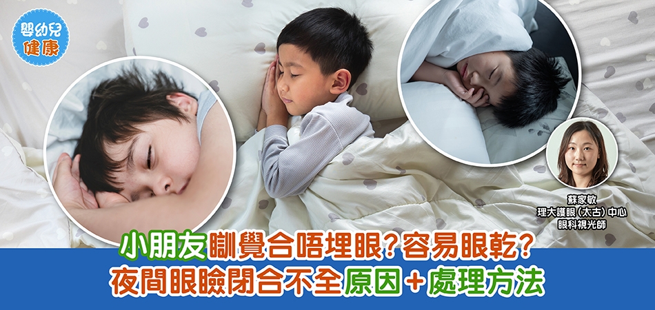 眼睛健康｜小朋友瞓覺合唔埋眼？容易眼乾？夜間眼瞼閉合不全原因+處理方法